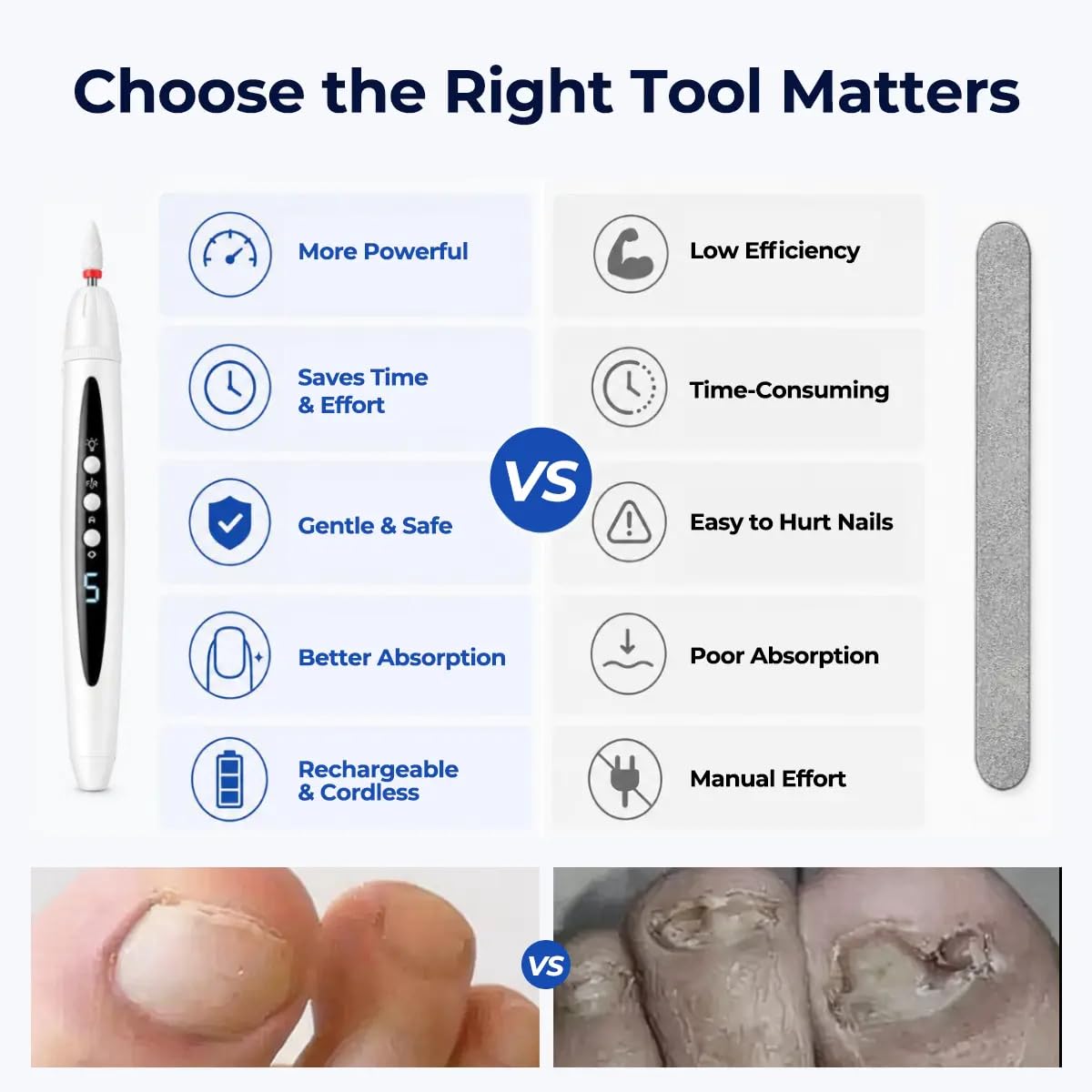 🔥Rechargeable Nail Drill, Cordless Electric File for Fungal Nails Care